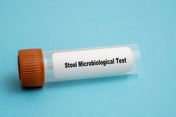 Stool Microbiological Test - obrazy, fototapety, plakaty