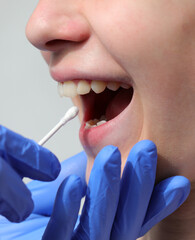 swab to search for the Covid-19 virus and the girl with her mouth open