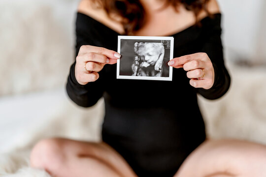A pregnant woman holds an ultrasound picture with her baby