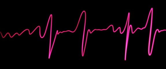 heart beat cardiogram