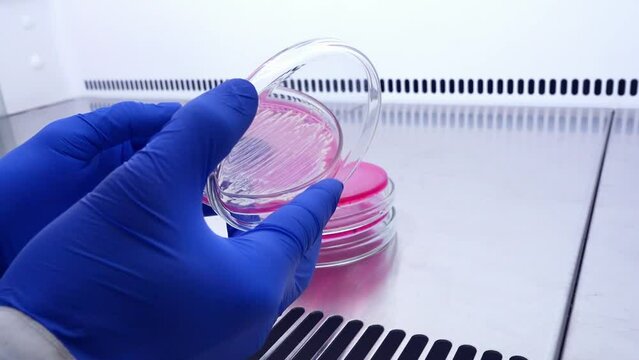 Close-up, first-person perspective, of a scientist opening a petri dish and examining bacqueria on a pink growth medium.