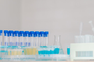 Numerous test tubes are used within epidemiological centers for research into the treatment of coronavirus. (COVID-19) that is spreading, causing many people to be infected.