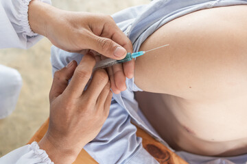 young man undergoes vaccination to prevent spread of coronavirus covid 19 which is currently spreading. doctor is holding a needle to vaccinate young men participating in the program.