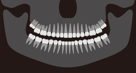 Human X-ray picture of teeth, vector illustration - obrazy, fototapety, plakaty