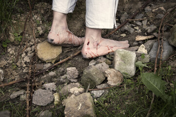 Wounded feet walk a hard rocky path