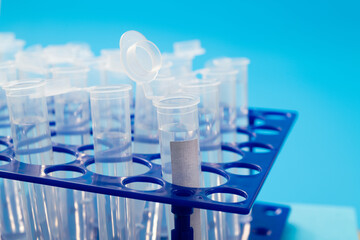 Test tubes with liquid on blue background