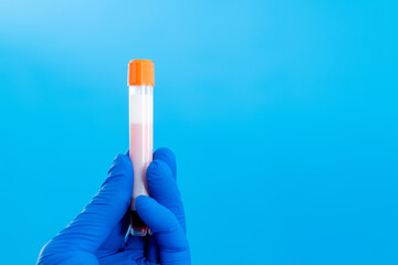 Hand holing a blood test tube with blank label