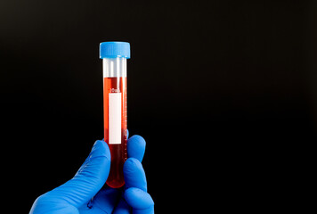 Hand holing a blood test tube with blank label