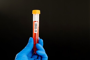 Naklejka premium Hand holding blood test tube with word COVID-19