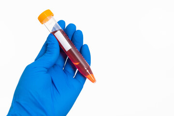 Hand holing a blood test tube with blank label