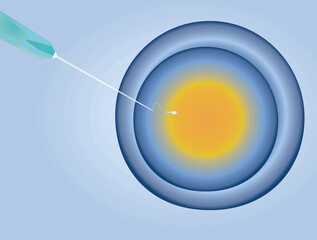 IVF insemination fertility. vector illustration