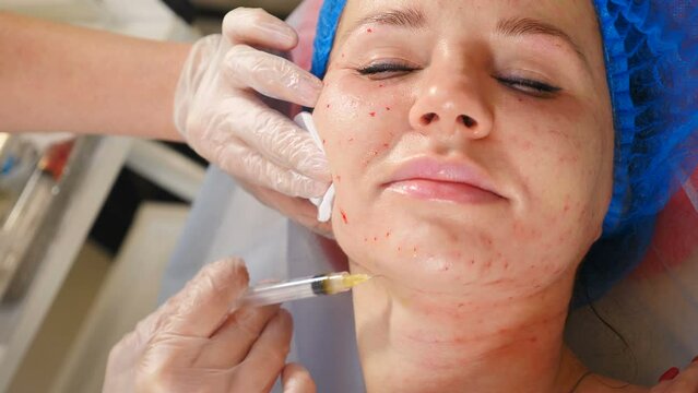 Modern beauty invasive procedure on face. Plasmolifting injections. Cosmetologist injecting stem cells to female patient. Dermatology anti-aging wrinkle treatment in clinic. Salon cosmetology face