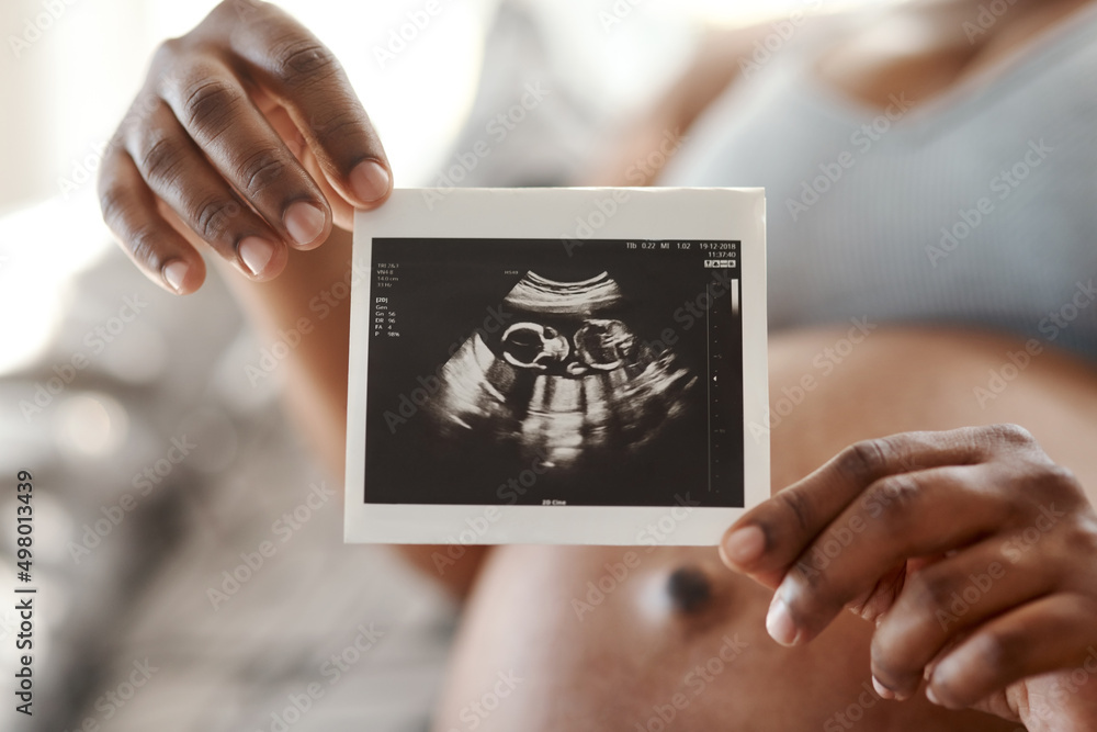 Poster The circle of life is such a miraculous experience. Closeup shot of an unrecognisable woman holding a sonogram at home.