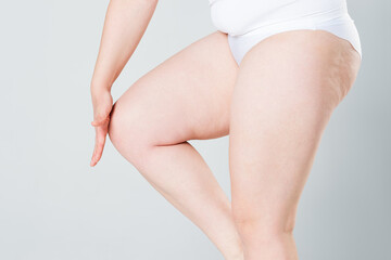 Overweight woman with fat thighs, obesity female legs on gray background