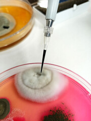 Performing fungal staining in the Microbiology laboratory