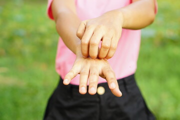 Woman scratching arm from itching . Cause of itchy skin include insect bitesConcept of health care...