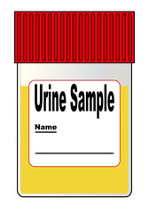 Urine Sample In Bottle