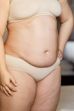 Cropped image overweight fat woman stomach with obesity, excess fat in underwear. Big size xl. Arms on waist. Stomach flabs with friable skin, visceral fat. Self acceptance, body positive. Close up