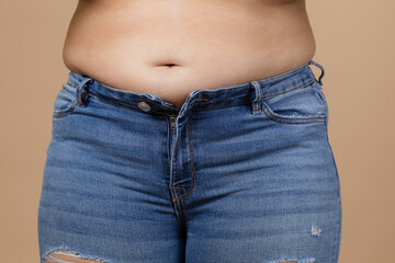 Caucasian lady showing big belly with large overweighted sides in blue jeans. Visceral fat. Body...