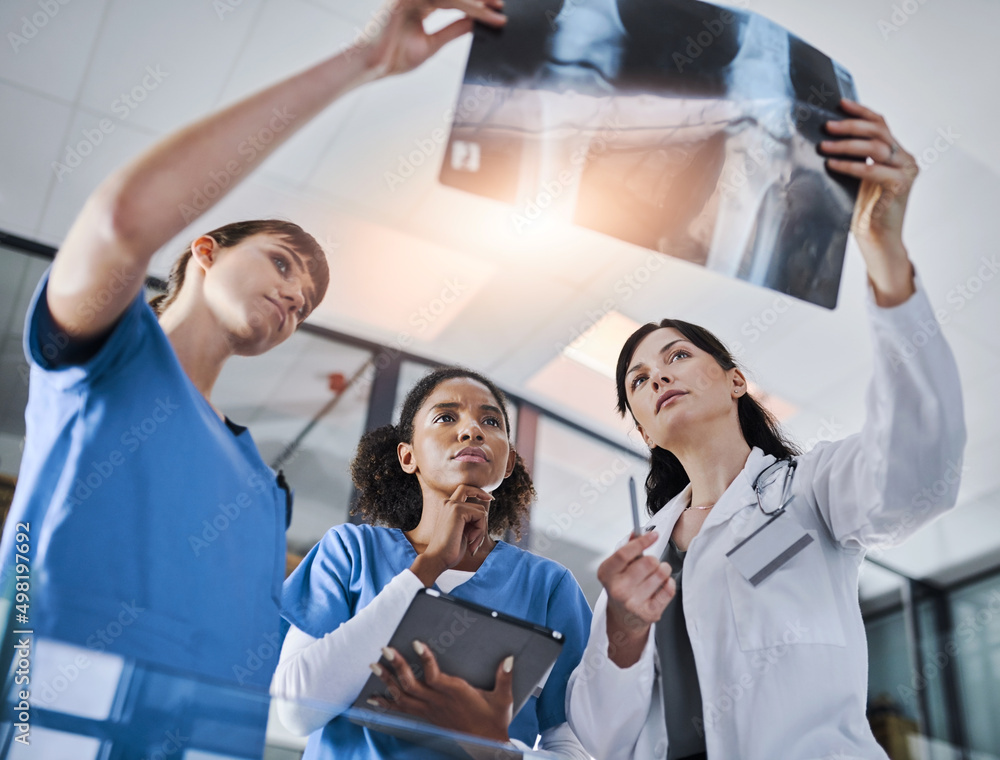Poster its all becoming clearer. shot of a group of doctors discussing the results of an x-ray in a hospita