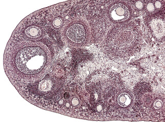Ovary (cross section) showing histology and maturation of follicle. Developing follicle. Follicular cells, granulosa cells, oogenesis.  Hematoxylin and eosin stain (H&E). 