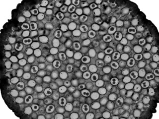 Eggs of horse roundworm (Ascaris megalocephala). Pronucleus (syncarion) stage. Light micrograph. 