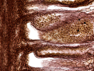 Longitudinal section of male pine (Pinus sylvestris) cone, showing microsporangium and pollen.