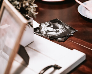Ultrasound or sonogram photos on a farmhouse styled table during gender reveal party