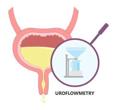 Urination Study Test Urine Leak EMG Urethral Flow Often Tract Exam Diagnose Diagnostic Therapy Bio Feedback Kidney Pelvic Muscle Floor Weak Organ Pain Urge Toilet Enlargement Stress Outlet Cancer