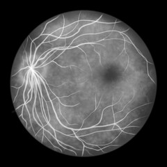 Normal eye retina, scientific illustration