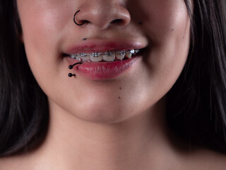 detail of teeth with braces and piercing on lips and nose of latina girl