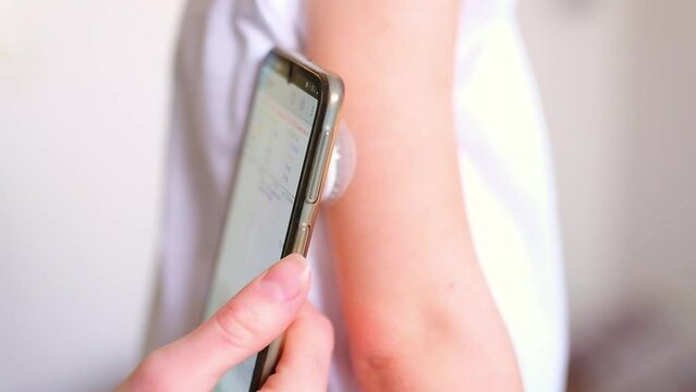 CGM -system of continuous monitoring of glucose on child's arm. Mother use smartphone for control glucose on blood her kid