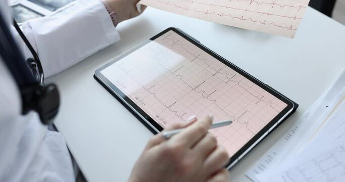 Cardiologist examines patient electrocardiogram closeup