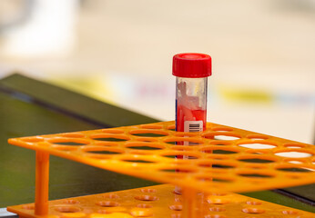 Disposable nucleic acid virus sampling tube