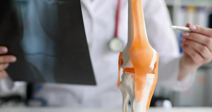 Doctor shows model of knee joint and muscles and tendons