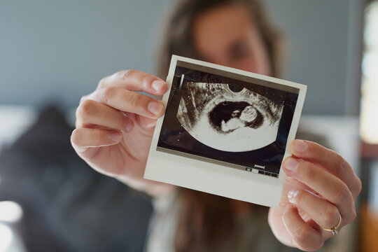 Look at my little peanut. Shot of a woman holding a sonogram of her unborn baby.