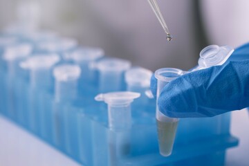 scientist using auto-pipette with Eppendorf consumables tube in the lab,Doing experiment for...