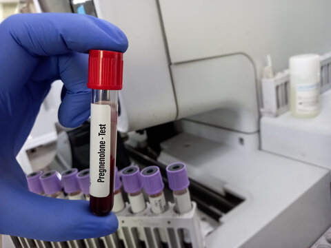 Blood Sample For Pregnenolone Test. To Help Detect And Monitor Treatment For Rare Types Of Genetic Conditions Such As Congenital Adrenal Hyperplasia (CAH)