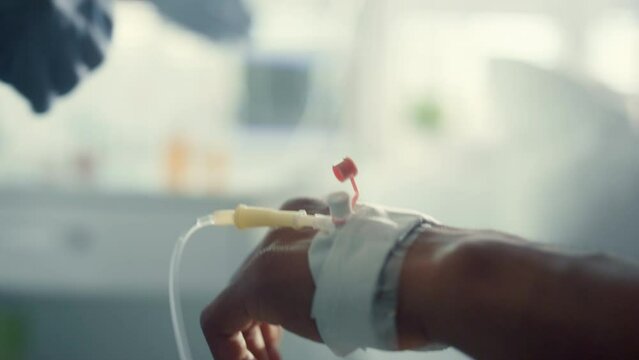 Doctor adjusting medical drip in ward. Patient hand with IV catheter closeup.