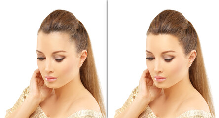 Alopecia Areata,female pattern baldness,Treatment for hair loss,Hair transplant,Surgery to implant...