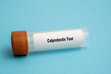 Calprotectin Test