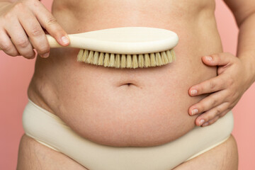 Cropped overweight woman belly with navel in pants with excessive weight, visceral fat abdomen....