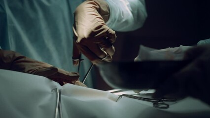 Surgeon hands using clamp operating room closeup. Hospital intensive care unit.