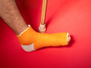 Foot with broken toe bone in orange fiberglass cast pink background. Injured fractured swollen male...