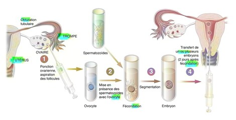 Diagram of the different stages of in vitro fertilization.