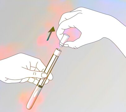 Dry swab for vaginal self-sampling.