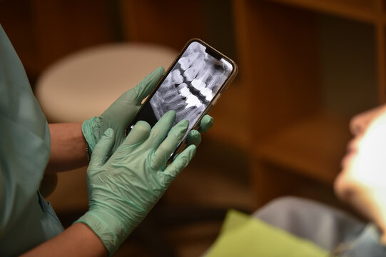 Closeup photo with dentist examining a patient's radiography on a phone