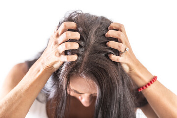 Brunette woman on isolated background scratching her head because of strong head itching