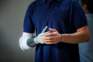 Man equipped with a robotic arm prosthesis.