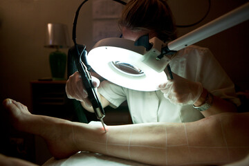 Laser hair removal session in a beauty salon.